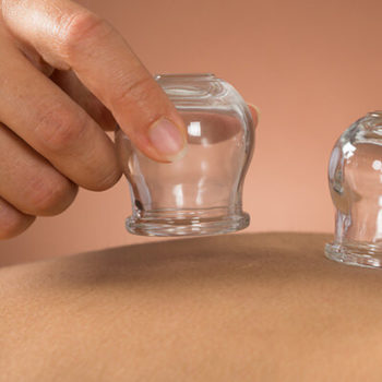 Myofascial Cupping in East Baton Rouge